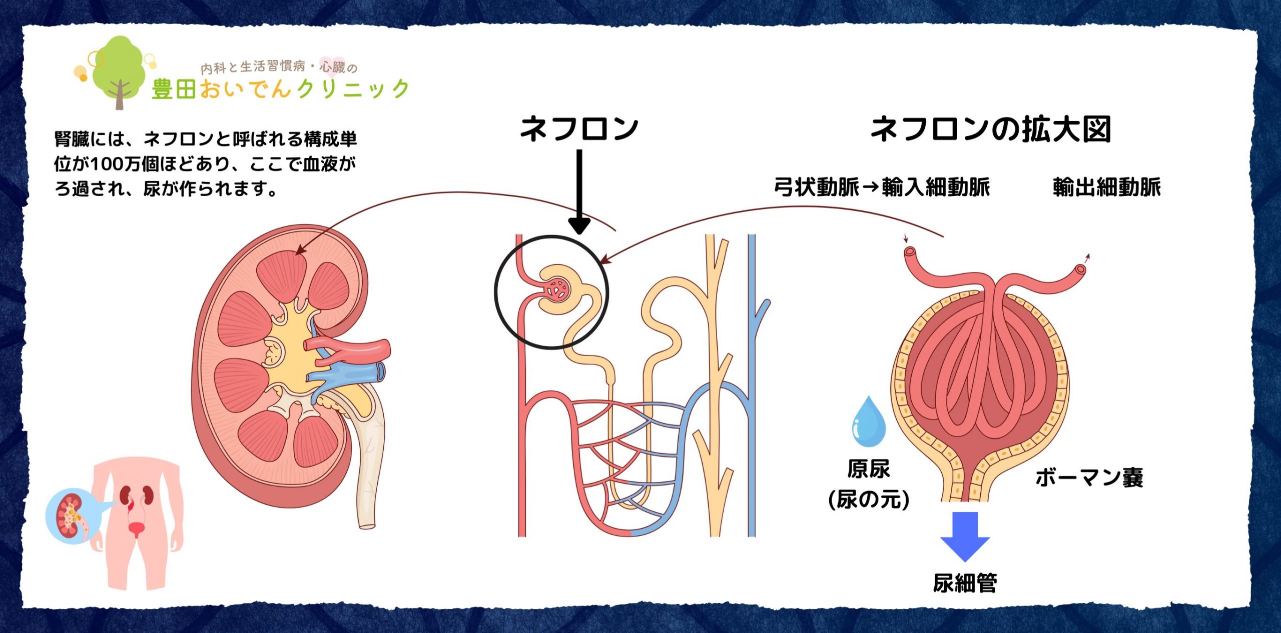 ネフロンの構造　弓状動脈　輸入細動脈　輸出細動脈　ボーマン嚢　原尿