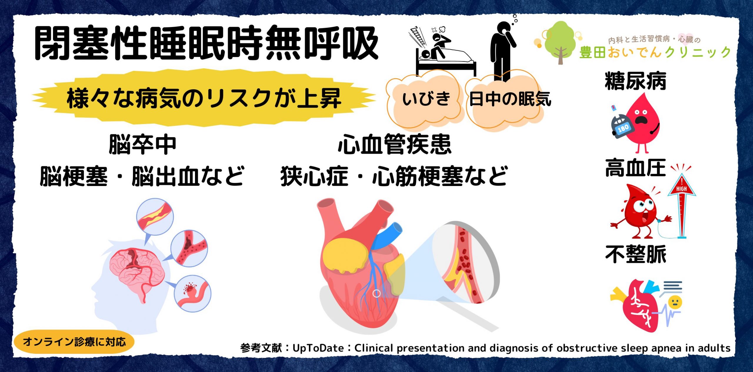 閉塞性睡眠時無呼吸(睡眠時無呼吸症候群)の症状と合併症に関する説明スライド。動脈硬化、脳卒中、狭心症、心筋梗塞、高血圧、糖尿病、不整脈のリスクが増加します。