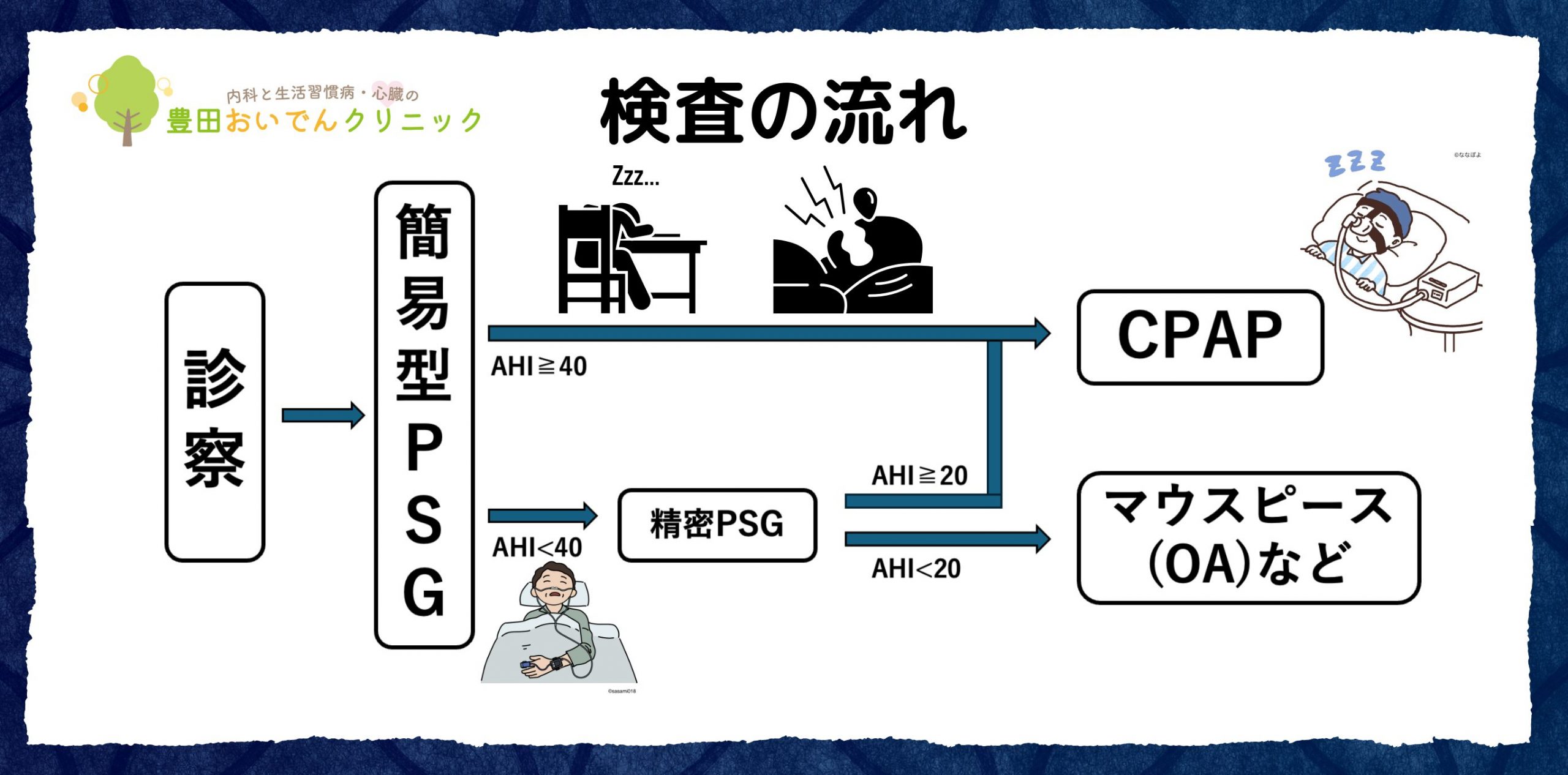 睡眠時無呼吸の検査の流れ。AHI>40, CPAP, OA, オーラルアプライアンス